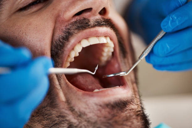 Best Teeth Whitening  in Fairmount, TN